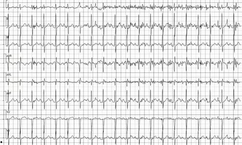 医院心电图拍照吃瓜网,揭秘医院里的“吃瓜”瞬间